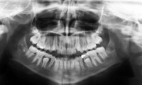 scrap dental x-ray film